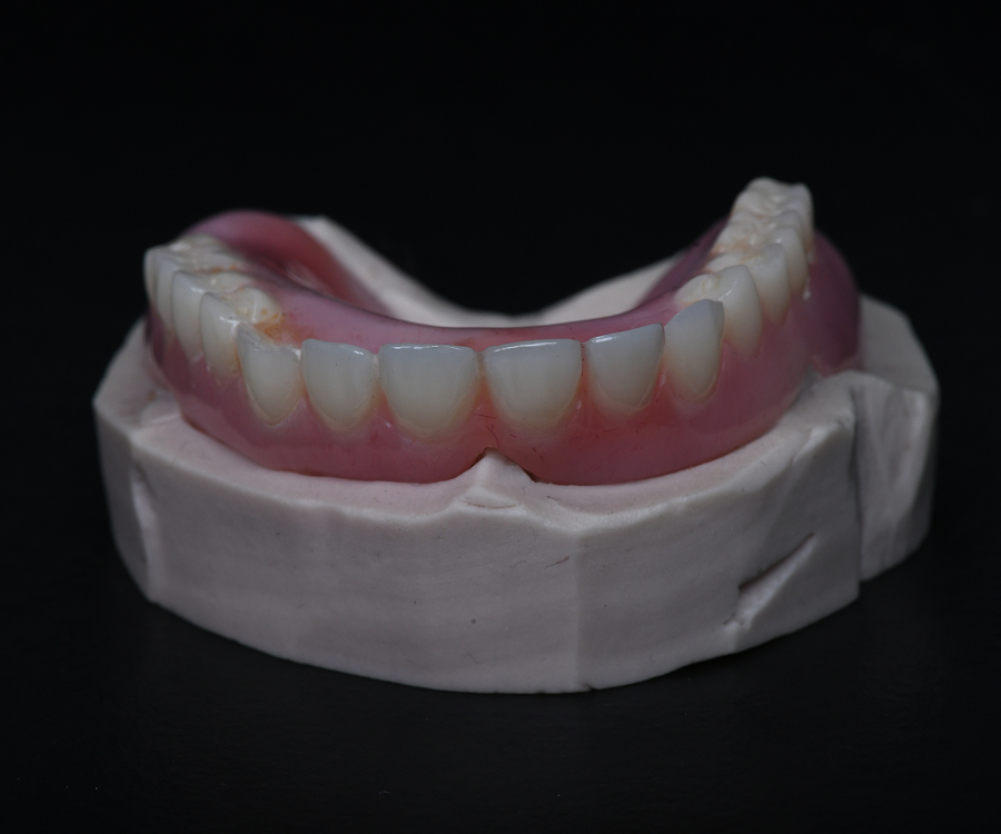 Dentures in Tampa, FL