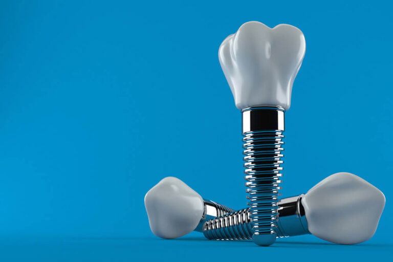 Types of Dental Implants